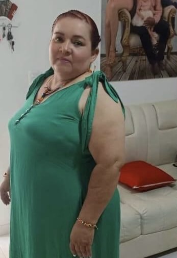 Testimonio Cirugia Bariátrica | Antes y Después