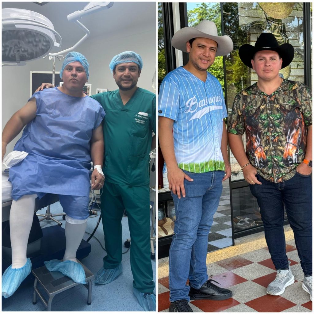 Antes y Después Cirugía Bariátrica Colombia