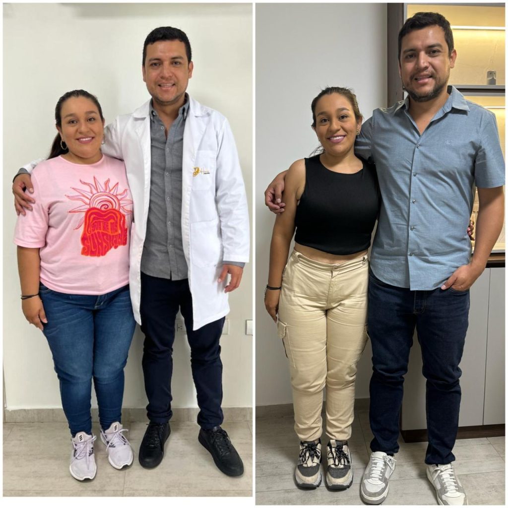 Antes y Después Cirugía Bariátrica Colombia