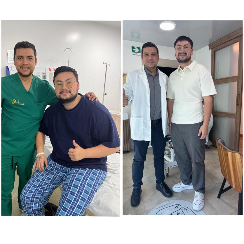 Antes y Después Cirugía Bariátrica Colombia